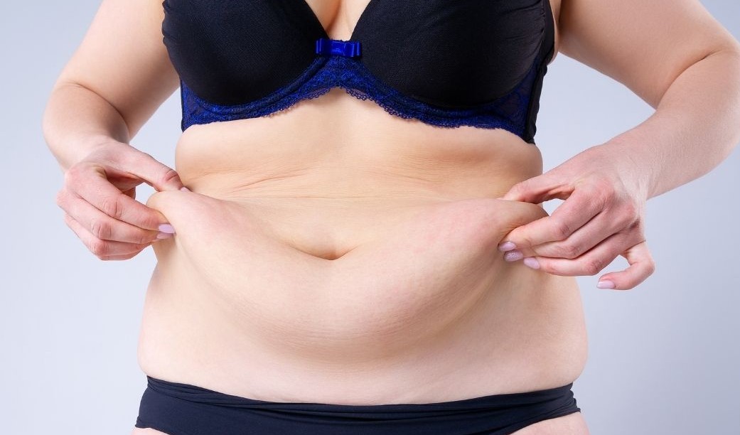  “¿Piel suelta o piel flácida? Son lo mismo?